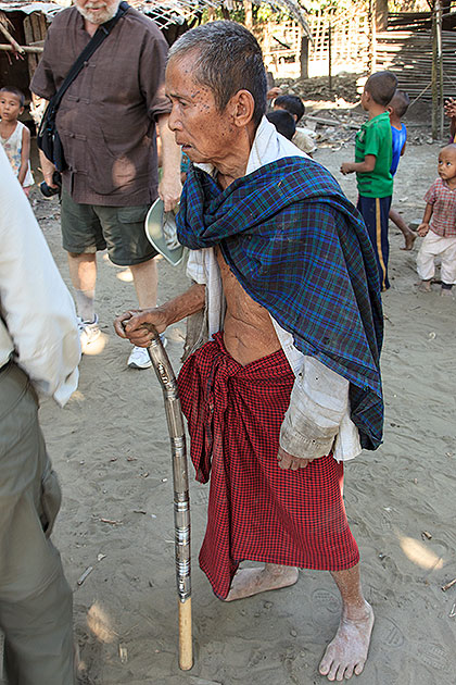 man with cane